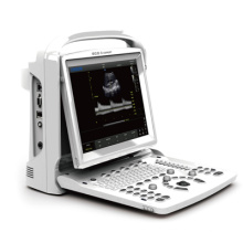 Ultraschall, Ultraschall-Scanner schwarz weiß Doppler Laptop Portable (SC-ECO3-Experte)